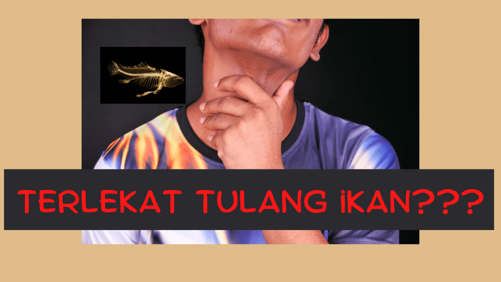 8 Cara Bantu ‘Hilangkan’ Masalah Tercekik Tulang&nbsp;Ikan